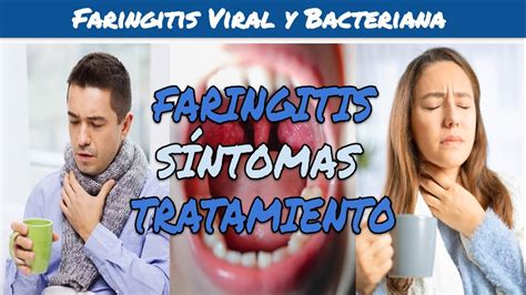 ⚕️🩺 Faringitis Viral Y Faringitis Bacteriana Síntomas Y Tratamiento