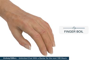 What Can Cause Boils On The Finger