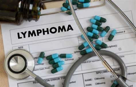 How Is Lymphoma Diagnosed Facty Health