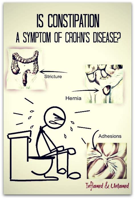 Pin On Crohns Disease