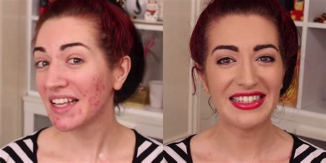 How To Cover Up Acne Scars With Makeup Makeup Tutorial