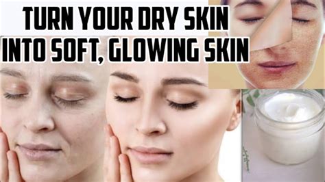 Home Remedy For Dry Skin Easy Diy For Dry Flaky Skin Dry Skin