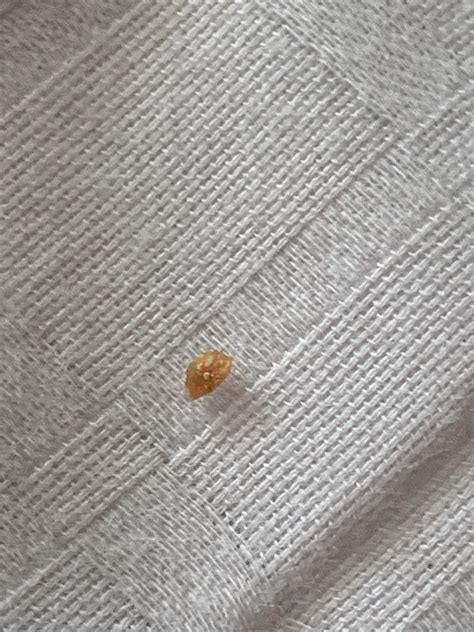 Is This A Bed Bug Shellcasing Rbedbugs