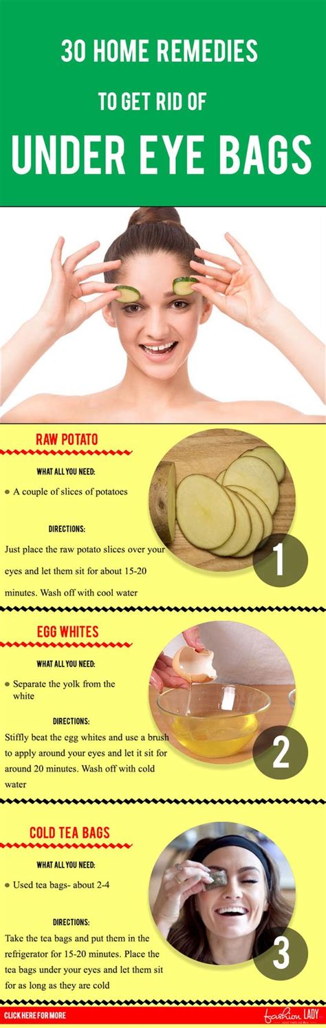 30 Home Remedies To Get Rid Of Under Eye Bags