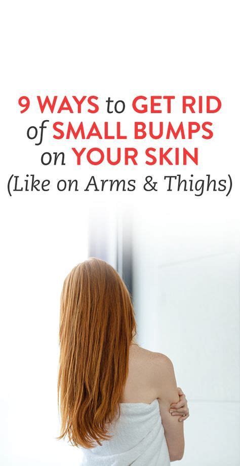 9 Ways To Get Rid Of The Small Bumps On Your Skin Aka Keratosis