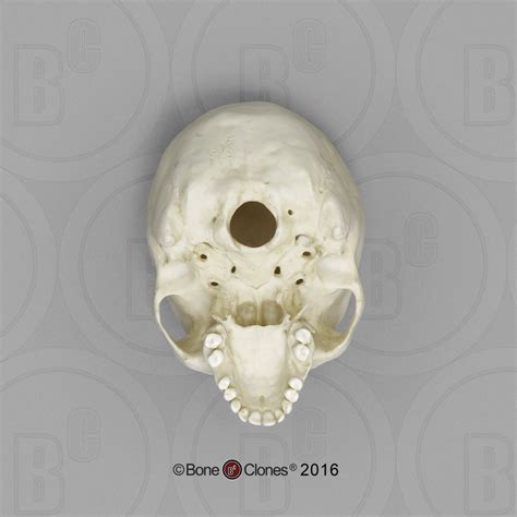 Human Female Skulls African Asian And European Half Scale Set Bone Clones Inc
