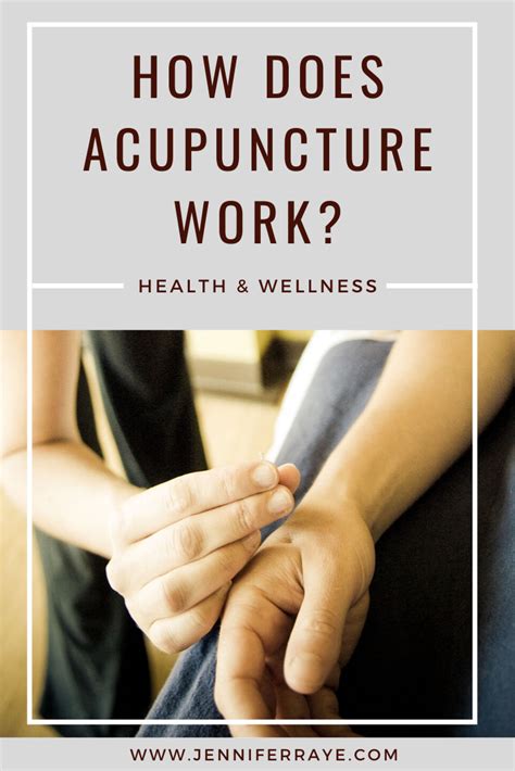 What Is Acupuncture How Does Acupuncture Work Learn The Fundamental