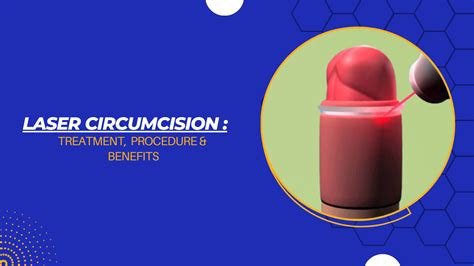 Laser Circumcision Treatment Procedure And Benefits