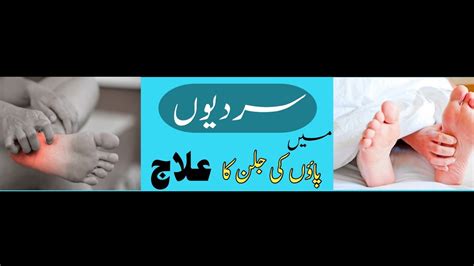 Treatment Of Feet Irritation Paon Ki Jalan Ka Ilaaj By Usama Anwar In Urdu Hindi Youtube