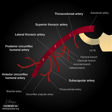 Axillary Artery Diagram Radiology Case Arteries