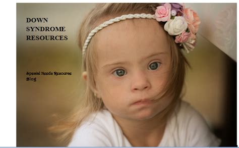 Down Syndrome Special Needs Resource And Training Blog