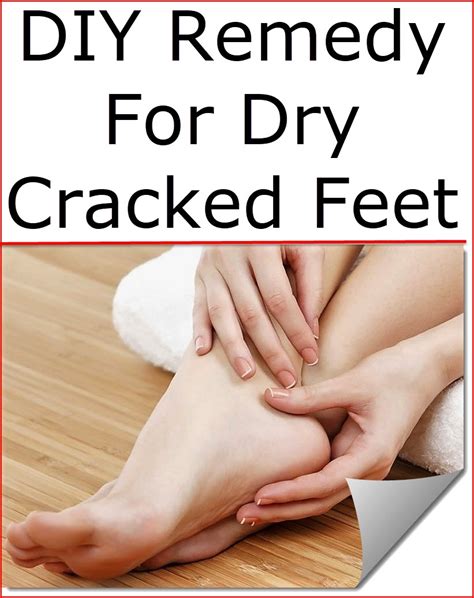 Diy Remedy For Dry Cracked Feet Listerine Foot Soak