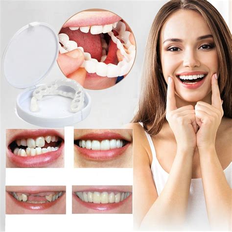 Snap On Smile Clip On Veneers Instant Smile In Seconds Cosmetic