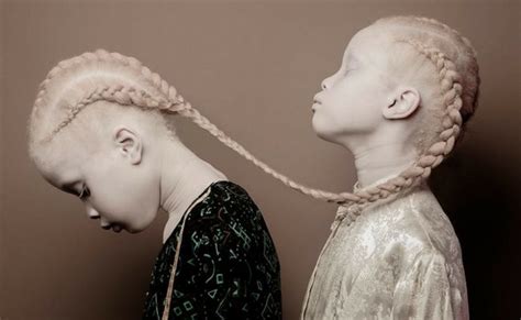 Lara And Mara The Albino Twin Models From Brazil Are The Talk Of The Fashion World With Their