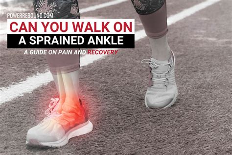 Can You Walk On A Sprained Ankle A Guide On Pain And Recovery