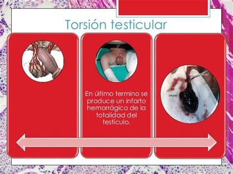 Patología Testicular 2014