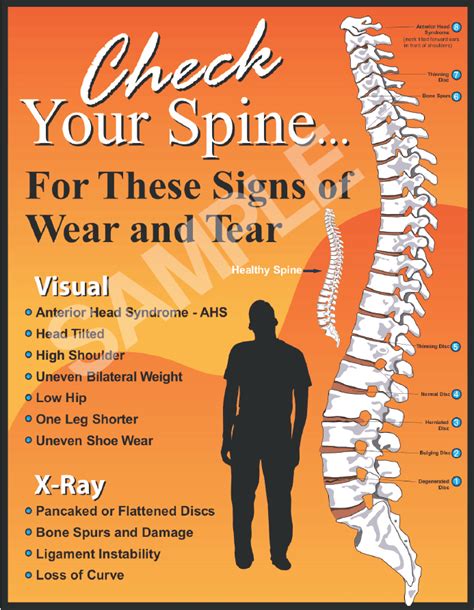 Check Your Spine Poster Posture Poster