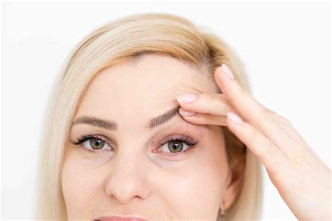 How To Fix Droopy Eyelids Dr Mark Doyle
