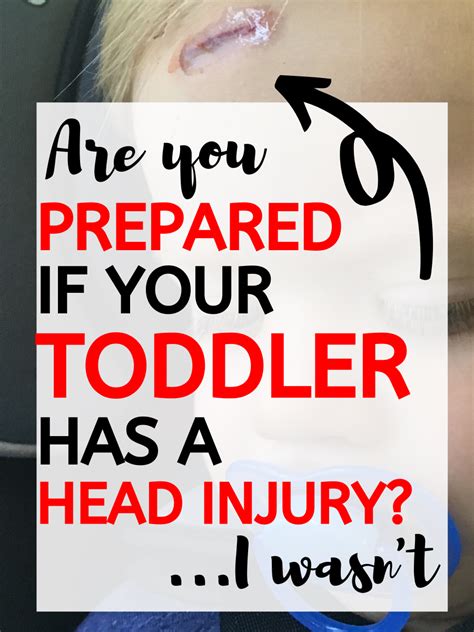 How To Prepare In Case Your Baby Or Toddler Has A Head Injury