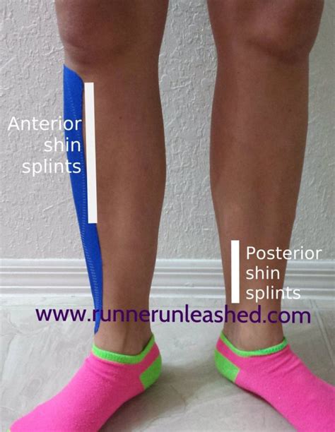 Anterior And Posterior Shin Splints Symptoms And Advice And Stretches