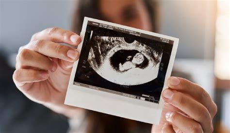 ssw 14 ultraschall untersuchung in schwangerschaft