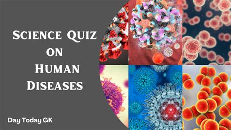 Science Quiz On Human Diseases And Disorders Day Today Gk