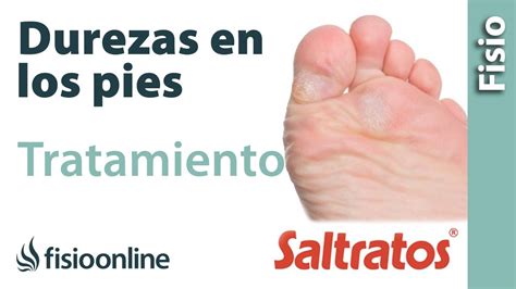 Callos Y Durezas En Los Pies Causas Consejos Y Tratamiento Youtube