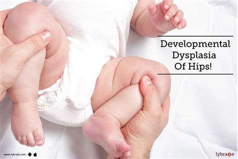 Developmental Dysplasia Of Hips By Dr Saurabh Chaudhary Lybrate