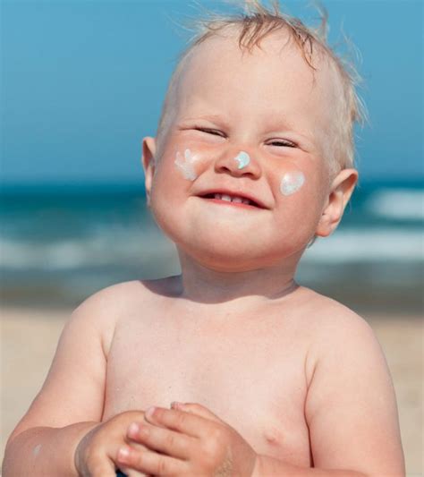 Sunburn In Babies Causes Treatment And Prevention