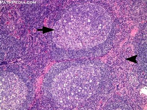 Histology Images Of Lymph Node By Pathology E Atlas