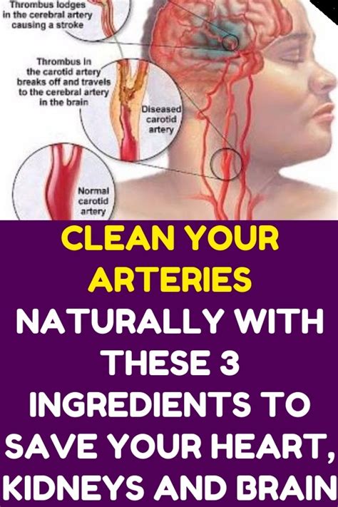 how to clean out plaque in arteries 3 ingredients mixture