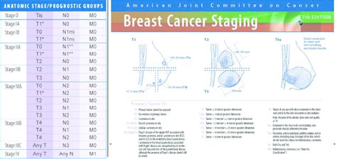 Breast Cancer Staging On The Basis Of Tnm Classification Download