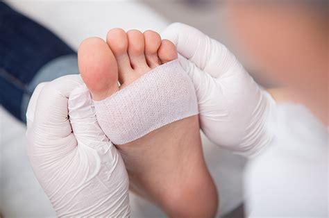 What Is A Diabetic Foot Skin Graft We Treat Feet Podiatry