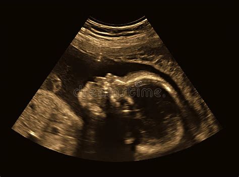 ultrassom do bebê na mulher gravida ilustração stock ilustração de vivo sonograma 56609283