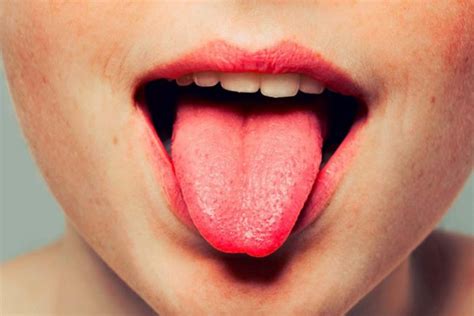 What are the possible causes of bumps under my tongue? How to Get Rid of Lie Bumps on Your Tongue (#9 Natural ...