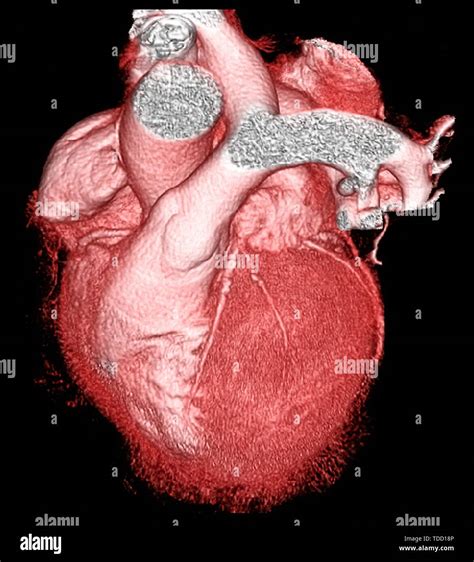 Healthy Heart 3d Ct Scan Stock Photo Alamy