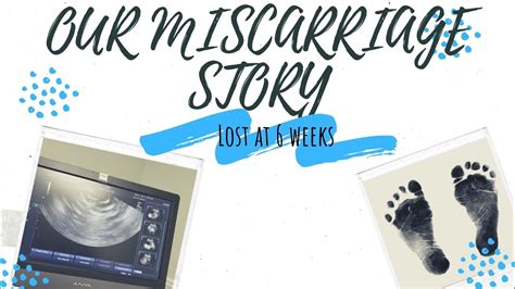 Our Miscarriage Story Miscarriage At 6 Weeks Youtube