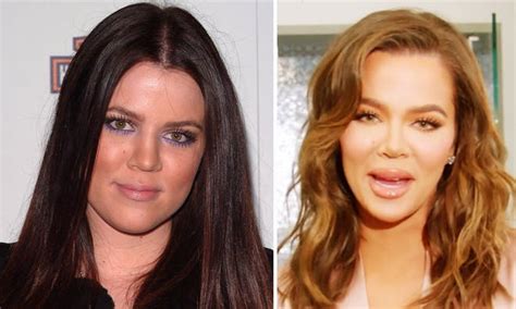 Khloe Kardashian Before And After Old Photos That Show Off Her