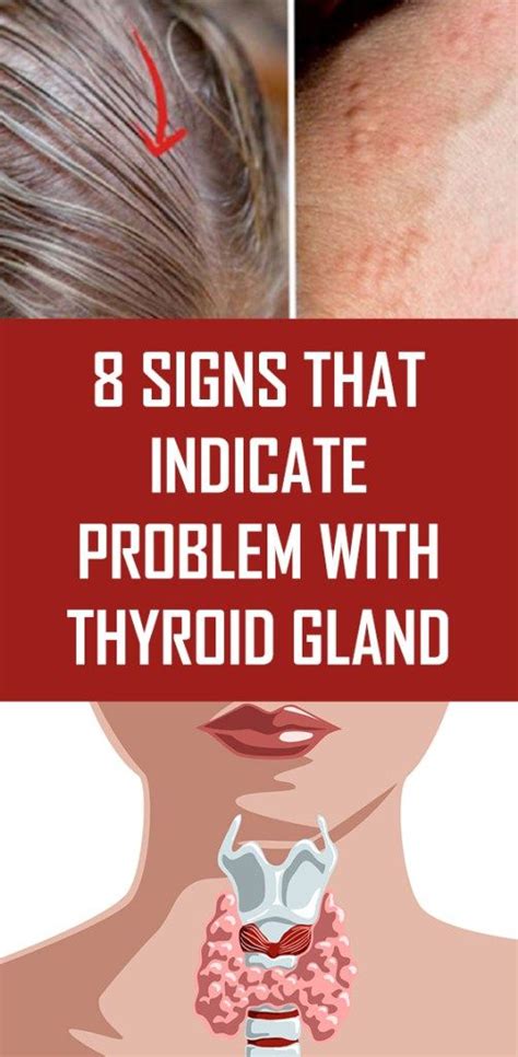 8 Signs That Indicate Problem With Thyroid Gland Thyroid Thyroid