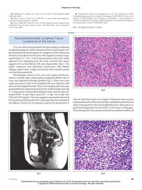 Pdf Mucosa Associated Lymphoid Tissue Lymphoma Of The Cervix