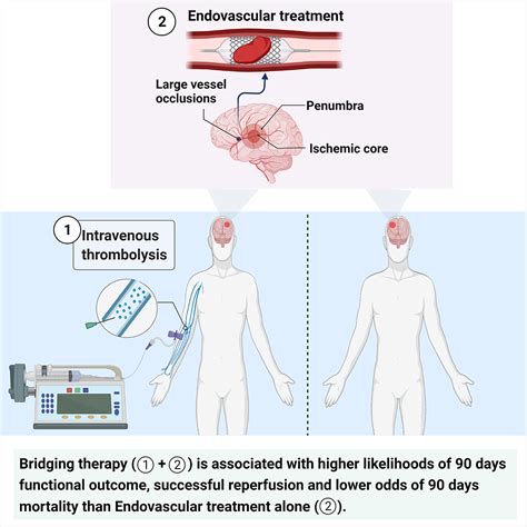 Frontiers Endovascular Treatment With And Without Intravenous