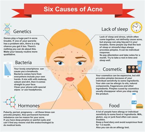 Causes Of Acne Skin Problems And Diseases Beauty Infographics Stock Vector Illustration Of