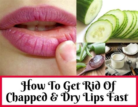 How To Get Rid Of Chapped Lips Fast Cure Home Remedies Trabeauli