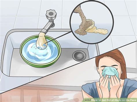 Pin on Face rash remedies