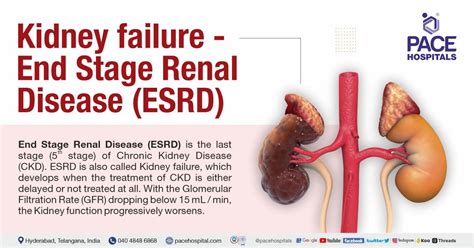 Kidney Failure End Stage Renal Disease Symptoms Causes And Treatment