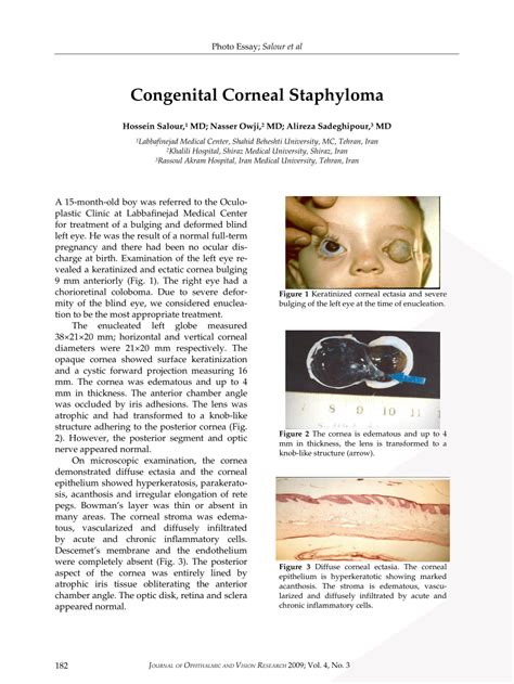 Pdf Congenital Corneal Staphyloma