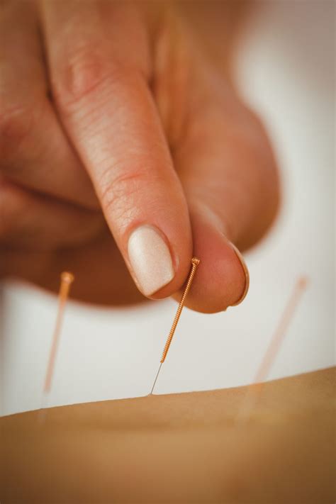 Akupunktur Praxis Für Augenheilkunde