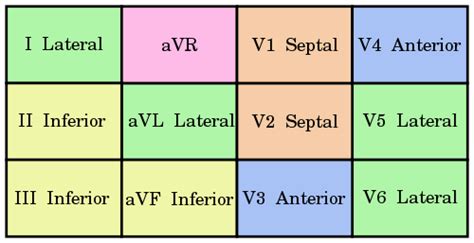 Acute STEMI Management - Mnemonic based approach | Epomedicine