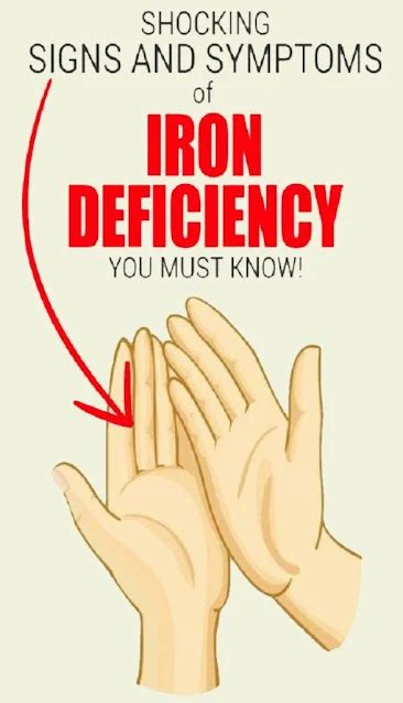 Signs Of Iron Deficiency You Should Never Ignore Healthy Lifestyle