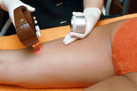 Five Tips To Help You Get The Best Out Of Laser Hair Removal Treatments